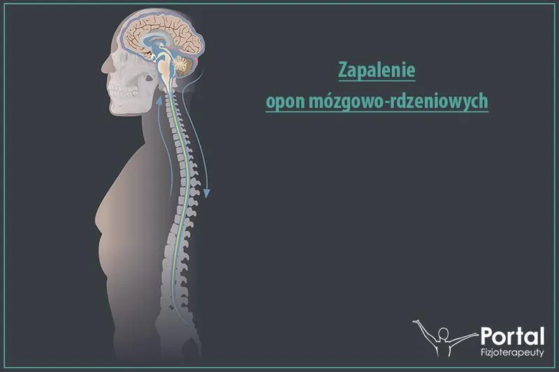 Zapobieganie zapaleniu opon mózgowych